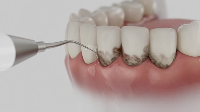 Reliable Tooth Extraction contractor in Denton County County, TX by Dentist Open Now